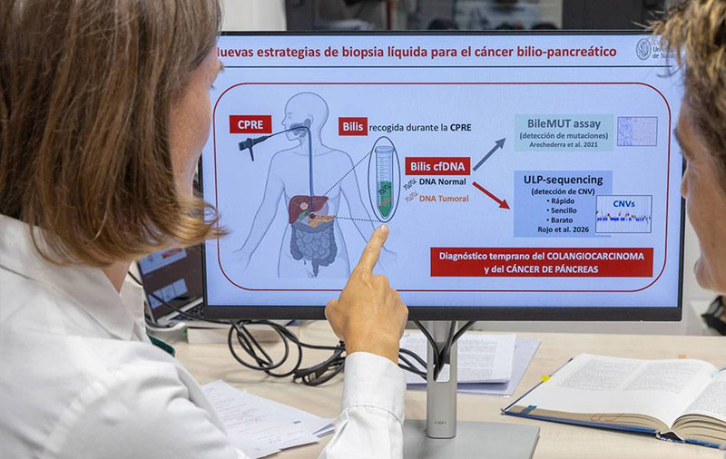 Investigadores del Cima Universidad de Navarra, en colaboración con el Hospital Universitario de Navarra (HUN) y Navarrabiomed, han demostrado que el análisis genómico del ADN circulante en la bilis mediante secuenciación del genoma completo a muy baja cobertura (ultra-low-pass whole-genome sequencing, ULP-WGS) aporta información complementaria de gran utilidad en el manejo de los pacientes con estenosis biliar.